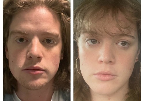 How long does it take to see changes on hrt?