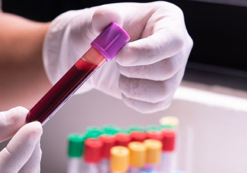 Is bloodwork necessary for hrt?