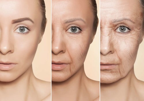 Does hrt boost collagen?